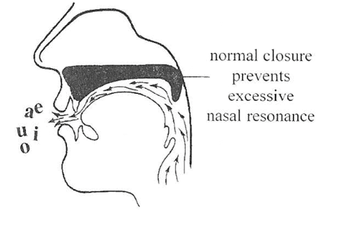 Diagram of normal velopharyngeal closure